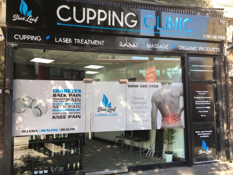 Cupping clinic- London